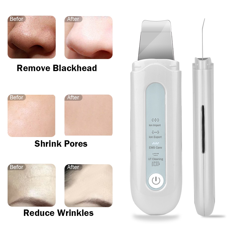 Acne Removal Skin Scrubber Acne Removal Skin Scrubber
